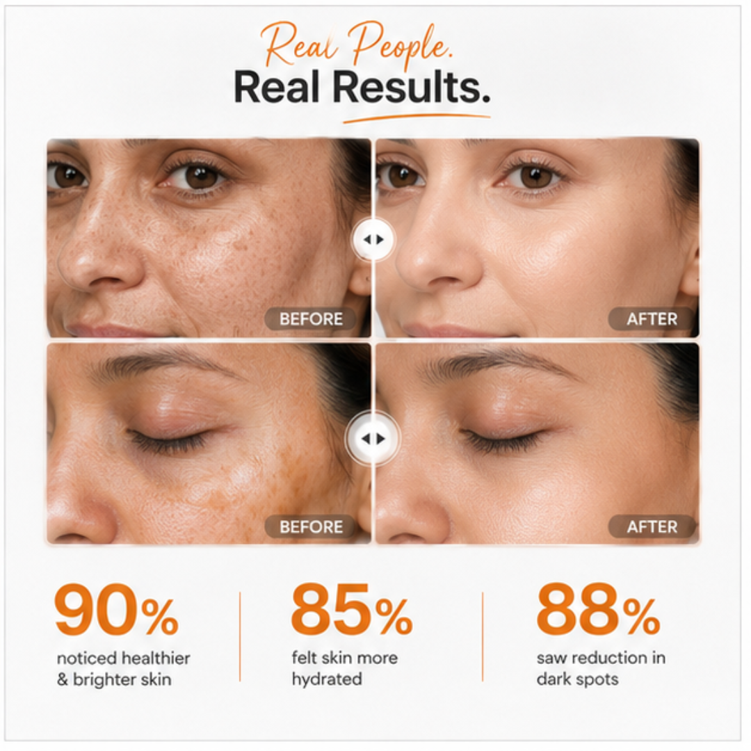 Mesoestetic Cream & Sunblock Deal - Reduce Pigmentation & Dark Spot - 50% Off - Complete care for hyperpigmentation