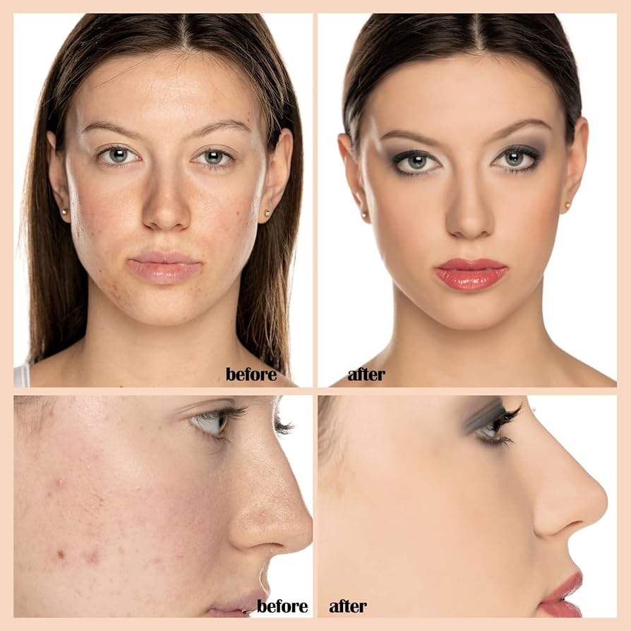 All in one High Coverage Tender Cream | Conceal, Cover & Hydration | Light weight & long-lasting | For all Skin Types