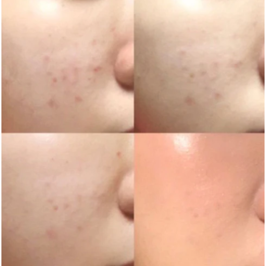 Mixsoon Glow Bean Essence – Hydrate & Heal (50ml)